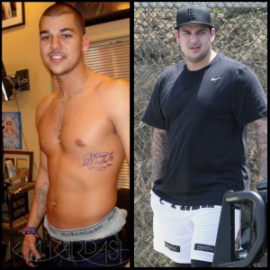 Rob Kardashian Before & After