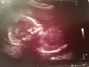 Baby Photo